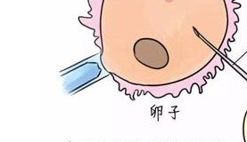 九江正规医院试管婴儿费用大概需要多少？需要注意哪些问题？