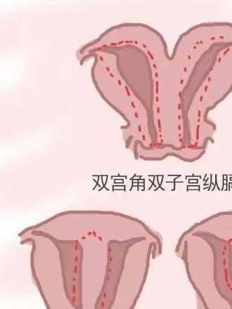 2026广东医学院附属第一医院三代试管价格多少？