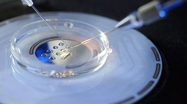 胚胎移植费用一般是多少钱？