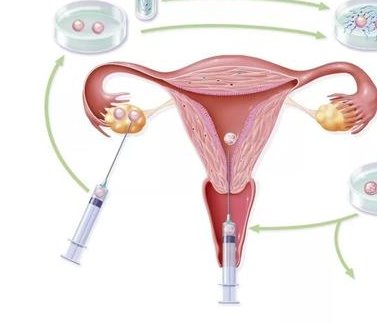 南阳有几家做试管婴儿的？选择试管婴儿医院标准是什么？